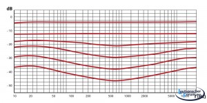 05_02_loudness.jpg - (130.18 KiB) 15873 mal betrachtet Quelle: https://www.thomann.de (War zu faul, deswegen schnell gegoogelt)